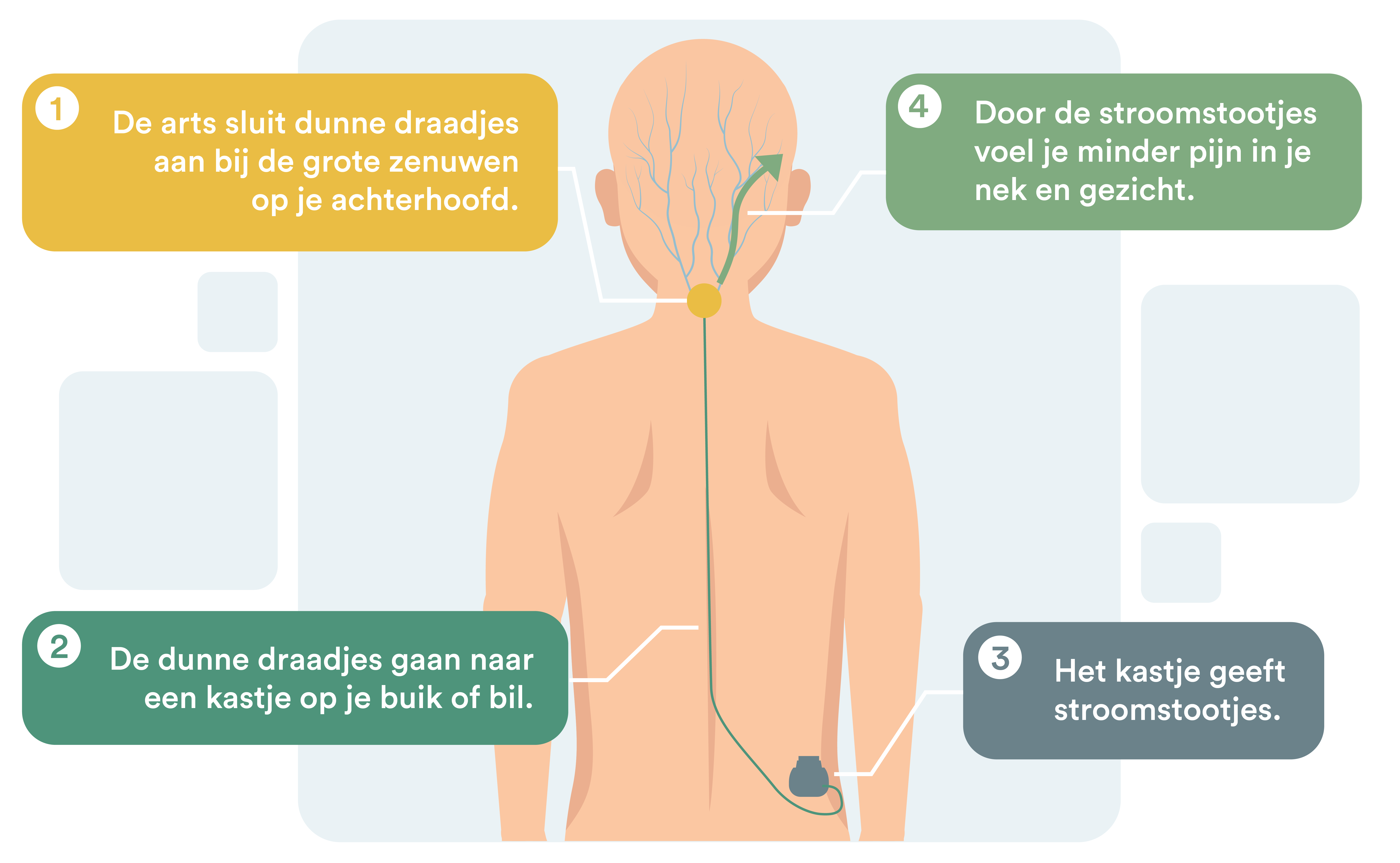 Je krijgt een sneetje in je nek. Vandaar gaan dunne draadjes naar een apparaatje op je bil of buik