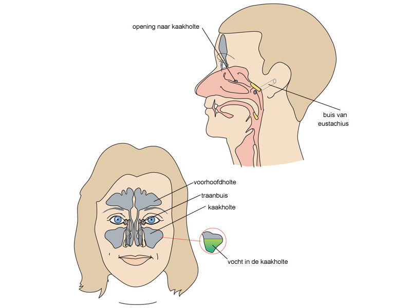 Een afbeelding van de bijholtes in het hoofd, gezien van de voorkant en van de zijkant