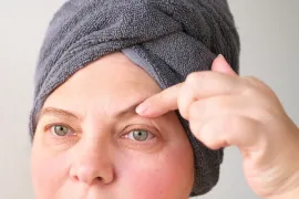 Vrouw heeft mogelijk ontstoken ooglid-rand