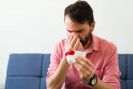Een man met een bloedneus knijpt zijn neus dicht met zijn hoofd een beetje voorover gebogen. In zijn andere hand heeft hij een zakdoekje met bloed erop.