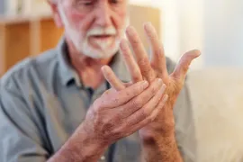 Een man met reumatoïde artritis pakt met zijn ene hand zijn andere vast