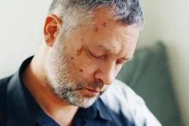 man heeft gordelroos